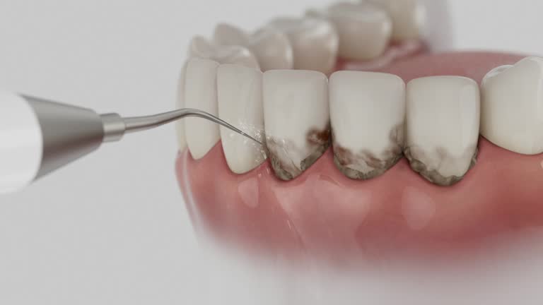 Trusted Tooth Extraction service in Candler-McAfee, GA - Dentist Open Now